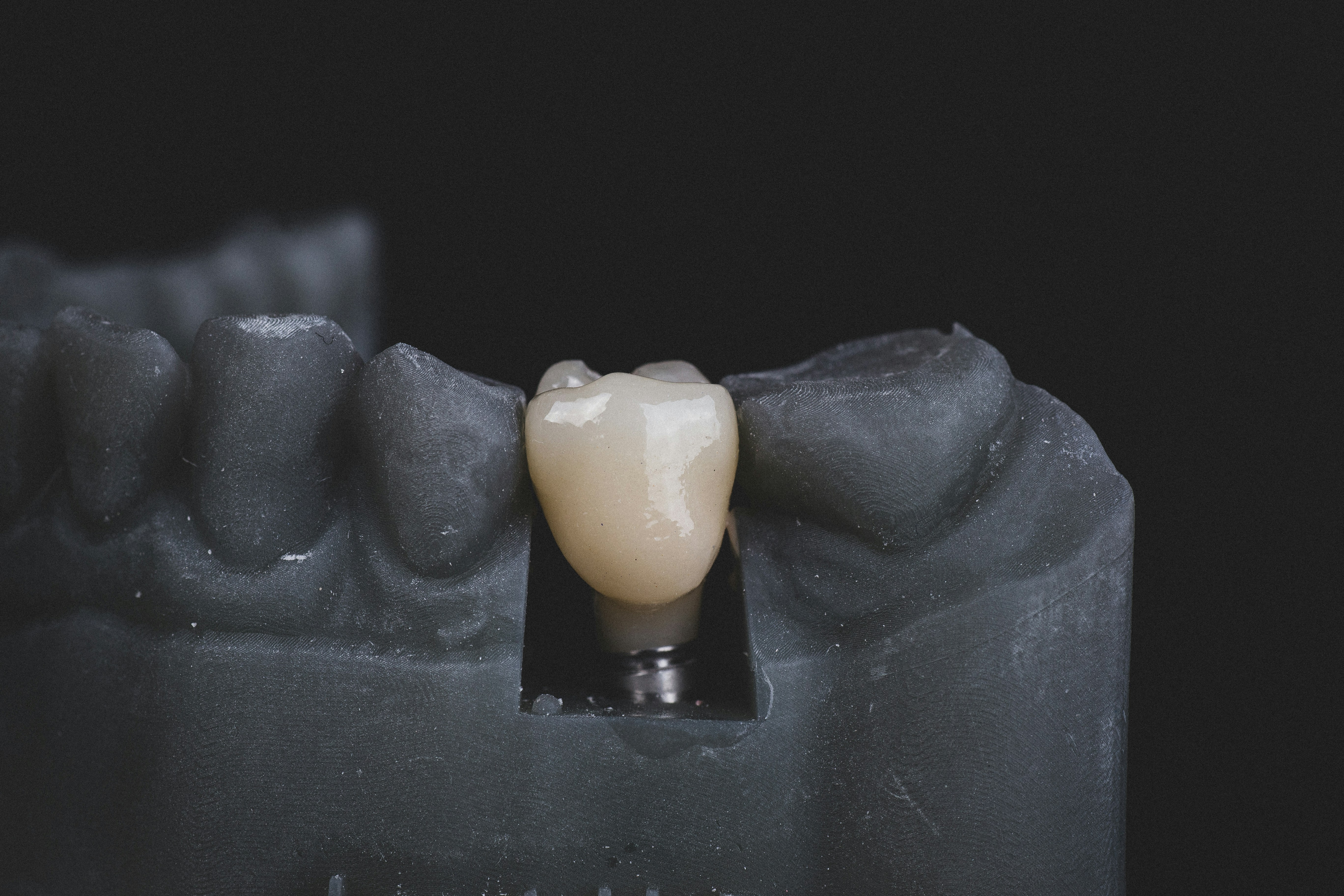 Prótesis dental